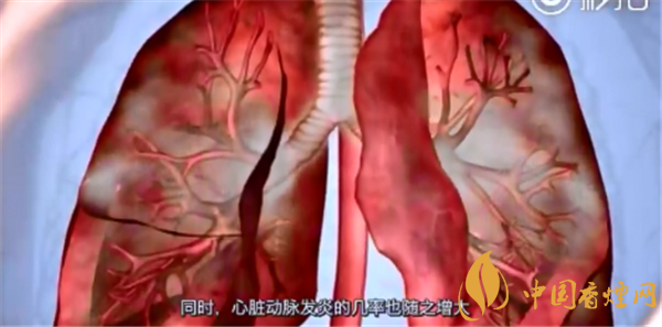 烟与肺癌的关系研究 与烟关系最为密切的肺癌是鳞癌