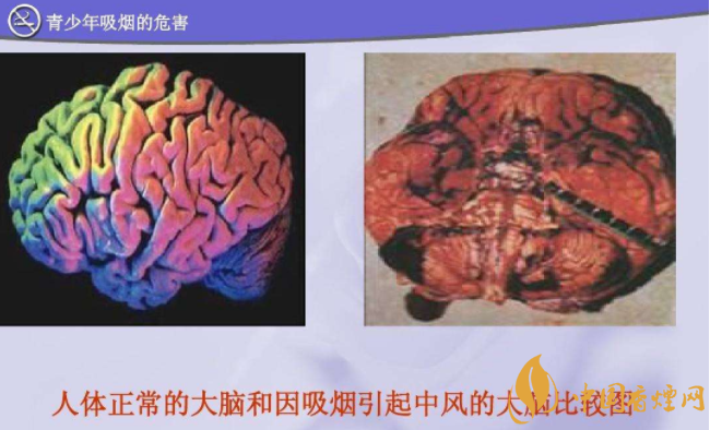 烟的危害：大脑与身体的双重打击
